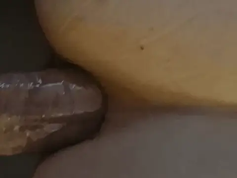 Anal