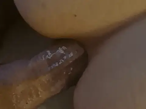 Anal